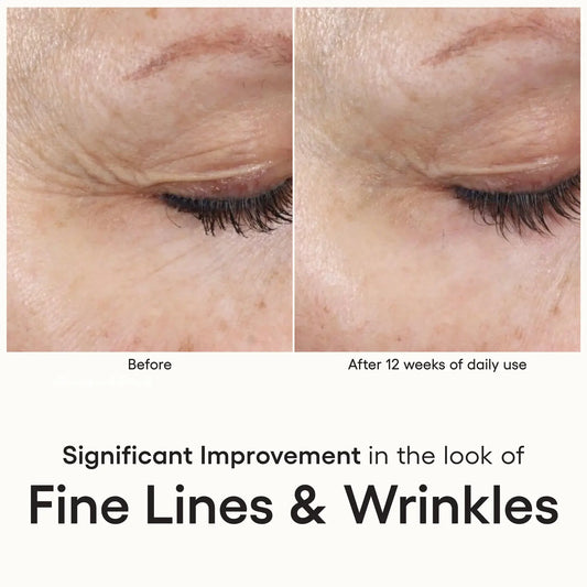 INTENSE Serum