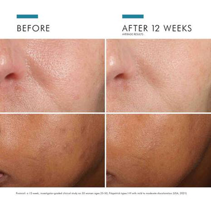 Phloretin CF with Ferulic Acid