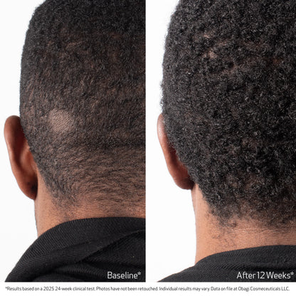 BIOSTIM™ SCALP SERUM